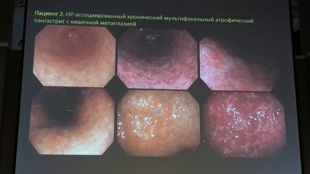 05 Куваев РО От грамотно выполненной биопсии до правильно ориентированного образца Оценка слизисто смотреть онлайн