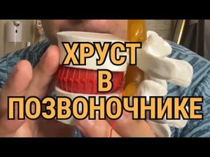 Что хрустит в позвоночнике? ￼