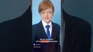 Алексей родился с деформированной головой