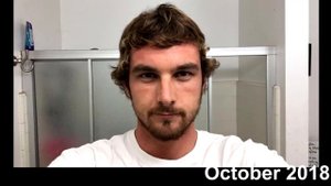 1 Year Hair Growth Timelapse