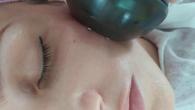 Горячий вакуумный массаж с RF-лифтингом по лицу (небольшой фрагмент для ознакомления) смотреть онлайн