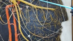 Тройничный нерв