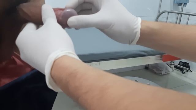 Ba câu hỏi đơn giản để xác định có bị HẸP BAO QUY ĐẦU hay không. смотреть онлайн