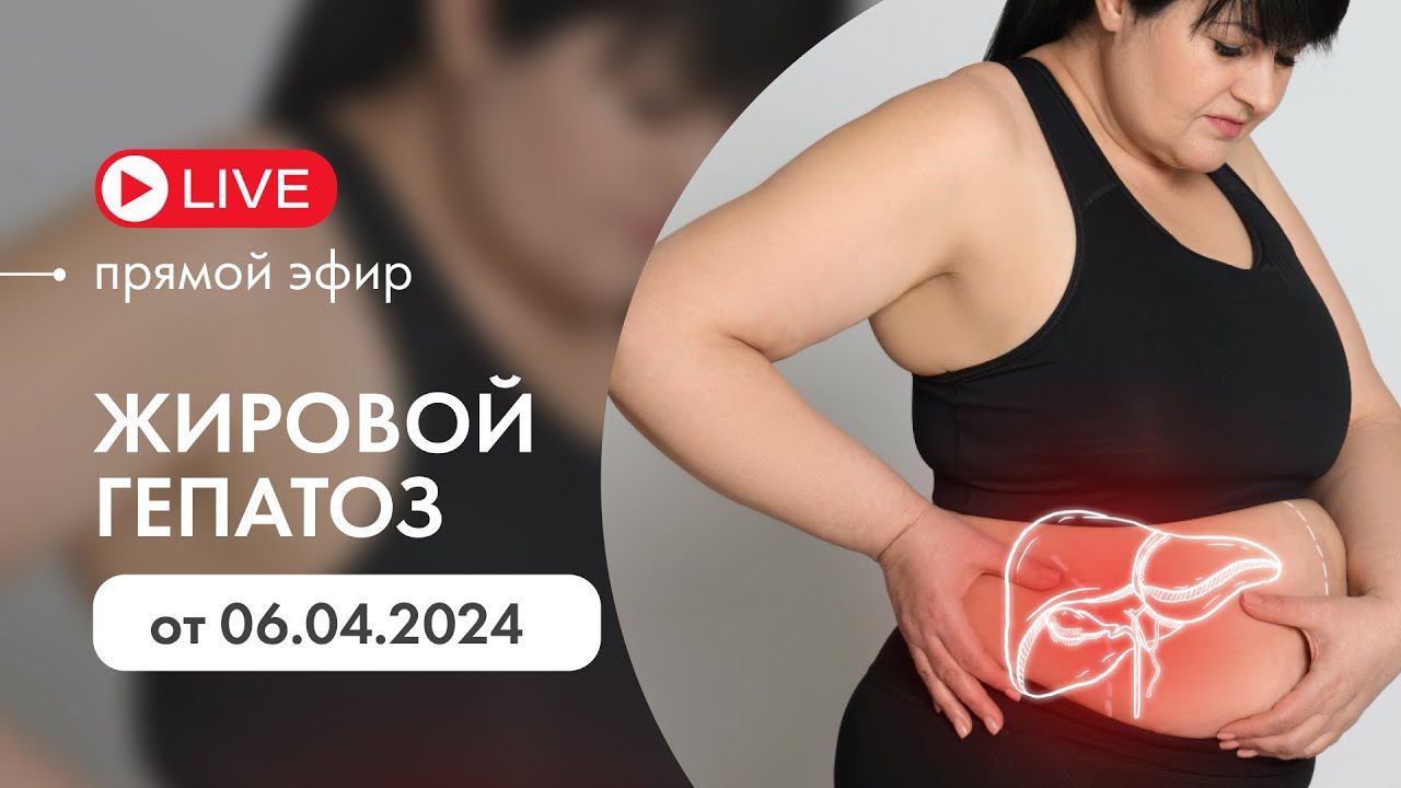 Жировой гепатоз