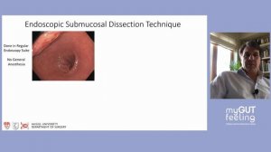 8  Dr.  Lorenzo Ferri - Innovations in Gastric Cancer Research: Implications for Therapy