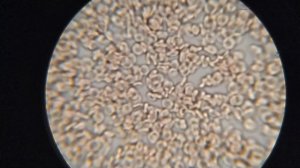 Влияние ОЛИВКОВОГО масла на кровь. ОБЪЯВЛЕНИЕ