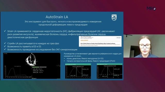 Комплексный подход в эхокардиографии. Автоматизация в действии. смотреть онлайн