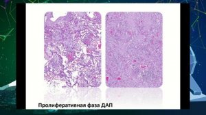 Мультидисциплинарная пульмонологическая школа - Самсонова Мария Викторовна