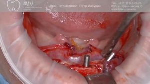 Все на четырех