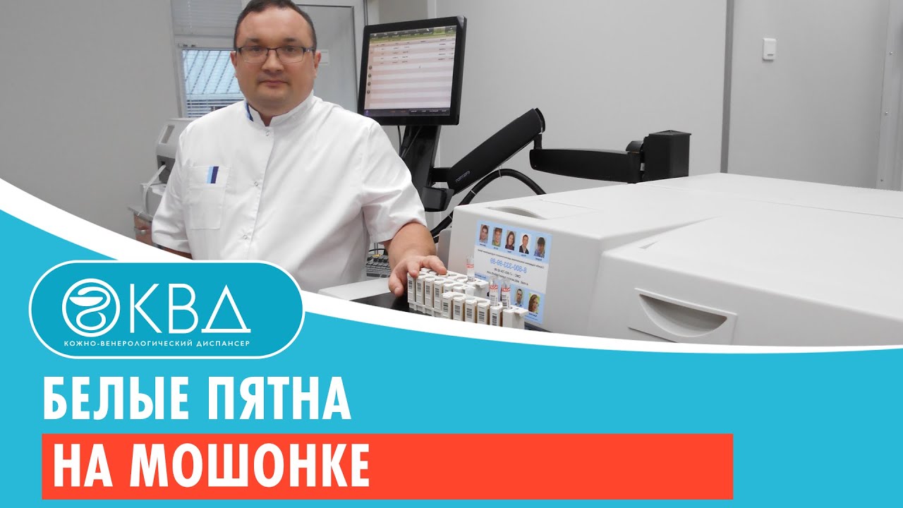 Белые пятна на мошонке. Клинический случай №129
