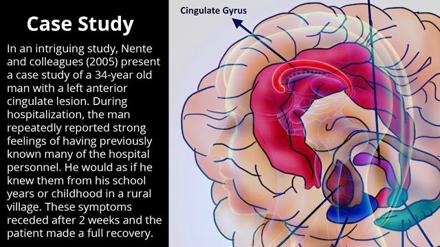 Cingulate Gyrus - Human Brain Series - Part 12 смотреть онлайн