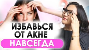 ЭФФЕКТИВНЫЕ СПОСОБЫ ИЗБАВИТЬСЯ ОТ ПРЫЩЕЙ РАЗ И НАВСЕГДА