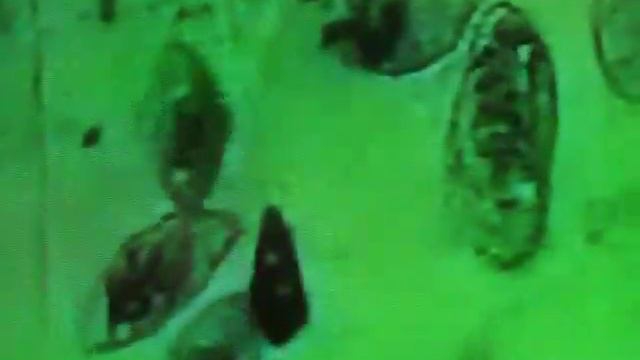 ? Микробы гибнут от прибора Хильды Кларк Zapper (Цеппер) - "электрический стул" бактерий смотреть онлайн