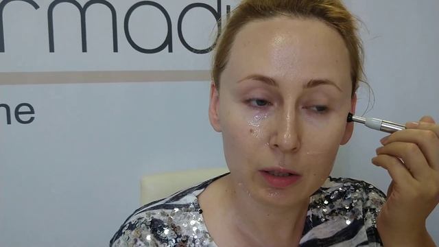 MESOFORM PRO vs носогубные складки, морщины вокруг губ смотреть онлайн