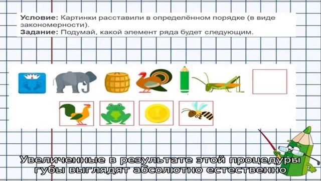 Тредлифтинг: увеличение губ с помощью мезонитей смотреть онлайн