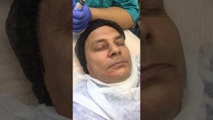 Аппарат ProFacial многофункциональный 6 в 1 (часть 1)