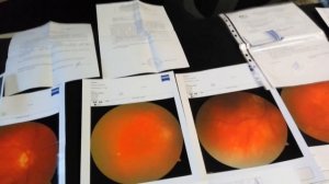 Отслоение сетчатки глаза. Исцели себя сам. Мои снимки и документы.