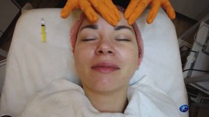 Протокол Пилинг PRX35