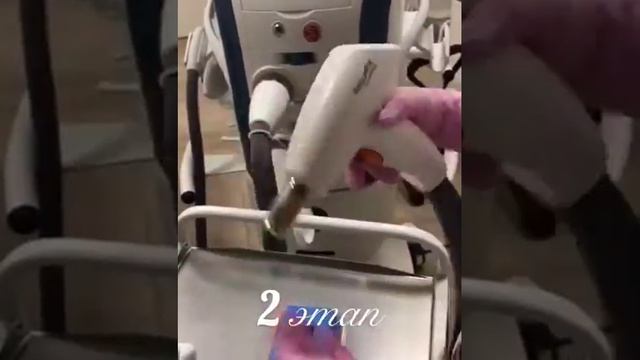 Процедура "photofractional" на аппарате М22 смотреть онлайн