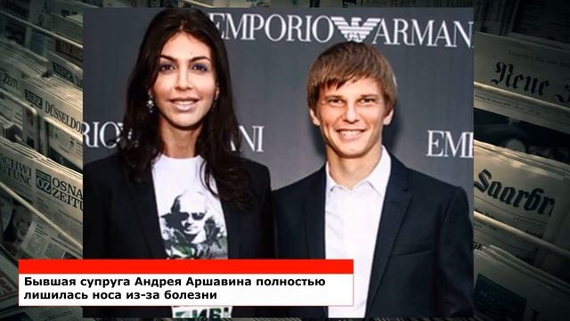 Бывшая жена Андрея Аршавина лишилась носа из-за ужасной болезни смотреть онлайн