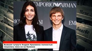 Бывшая жена Андрея Аршавина лишилась носа из-за ужасной болезни