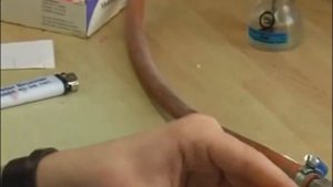 Шаблоны прикуса - зубной протез