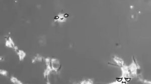 Как то так выглядят нейроны, пытающиеся вернуть забытую мысль