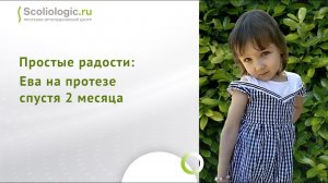 Протез с двойным следом спас Еву от ампутации ноги