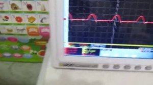 Резонанс в резонансе - ответка среды в резонансных системах