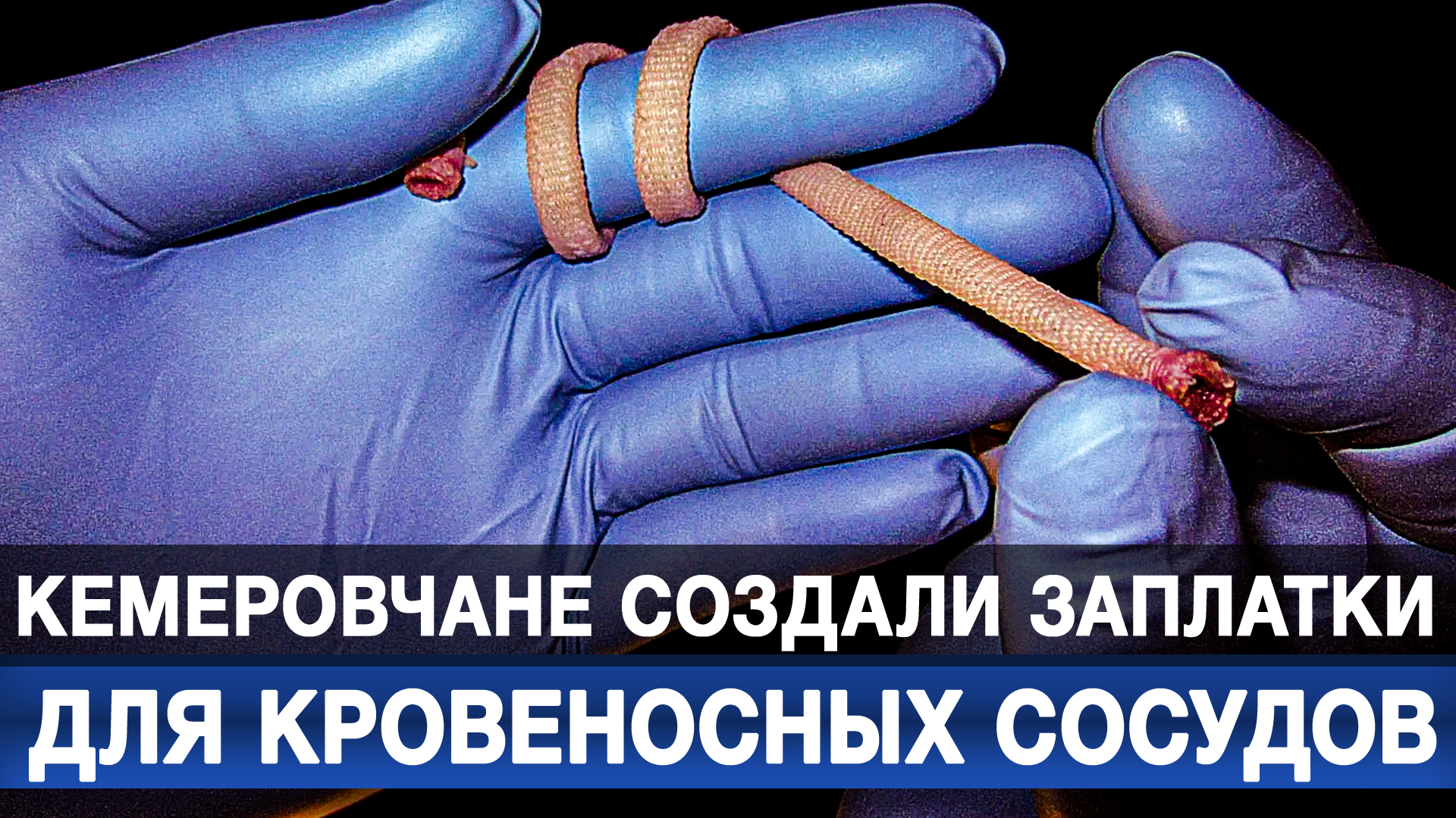 Кемеровчане создали заплатки для кровеносных сосудов