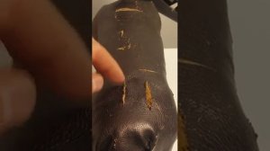 Что будет если не зашить рану. Почему её шьют именно таким образом