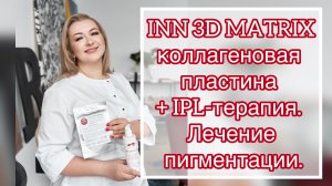 IPL-терапия. Лечение пигментации + INN 3D MATRIX коллагеновая пластина.