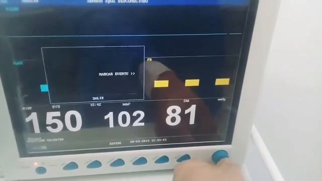Monitor de signos vitales Edan M8 En venta смотреть онлайн