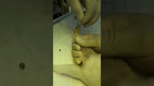 Удаление 5-ых пальцев у трех-дневного щенка.