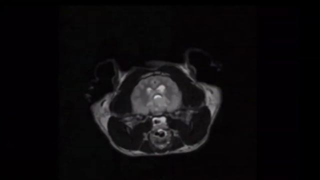 МРТ в СВЦ МЕДВЕТ. смотреть онлайн