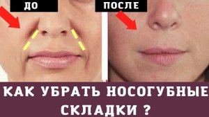 Убрать Носогубные Складки КИСЕТНЫЕ МОРЩИНЫ Тейпирование верхней губы.mp4