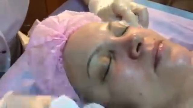 Пилинг-3 этап ..... смываем пилинг смотреть онлайн