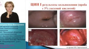 Интраэпителиальные поражения шейки матки легкой и тяжелой степени: диагностика и тактика ведения