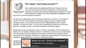 деформация большого пальца стопы