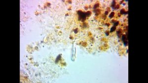 Водопроводная вода под микроскопом 1000х