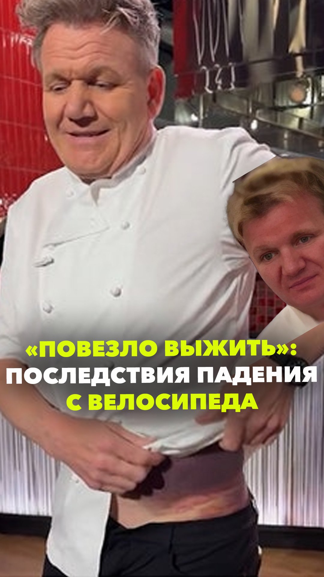 «Выгляжу как фиолетовая картошка»: шеф-повар Гордон Рамзи показал огромный синяк после аварии