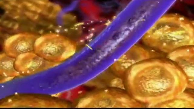 Прессотерапия Волгоград.mp4 смотреть онлайн