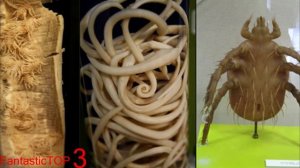 ТОП 5 анатомические музеев мира