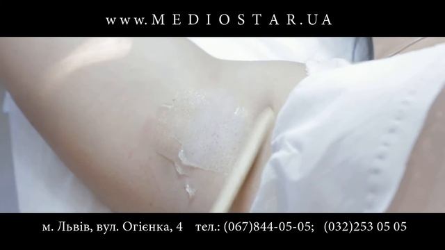 Центр лазерної епіляції та косметології "Медіостар" смотреть онлайн