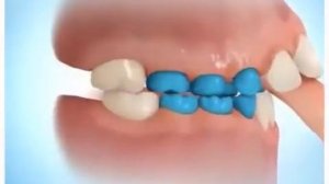 Сосание пальца: чем плохо?