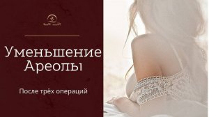 Татуаж ареолы груди. Камуфляж рубцов. Исправление ареолы груди после пластики.