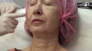 Первичная оценка пациента. Игла или канюля?