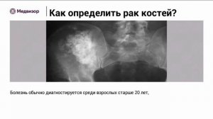 Как определить рак костей?