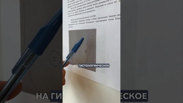 Зачем делать маммографию. Рассказываю случай из практики смотреть онлайн