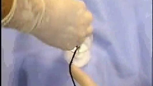 Хирургический узел 11